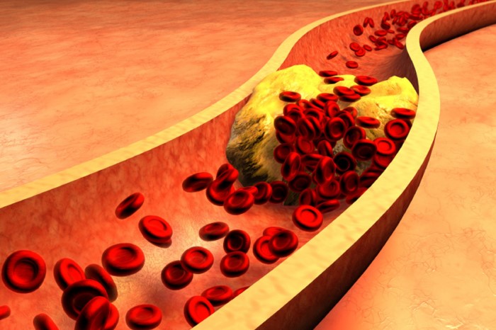Hạnh nhân giúp giảm lượng cholesterol đáng kể
